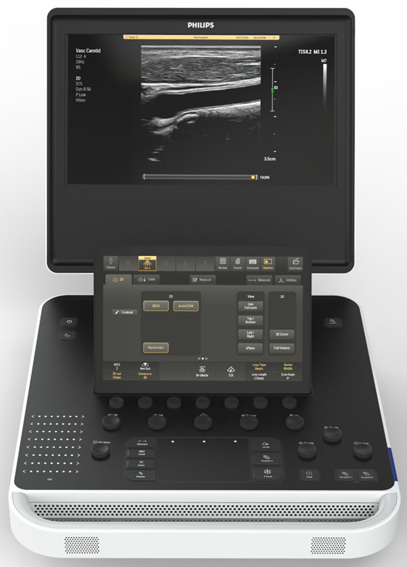 philips 5500 ultrasound