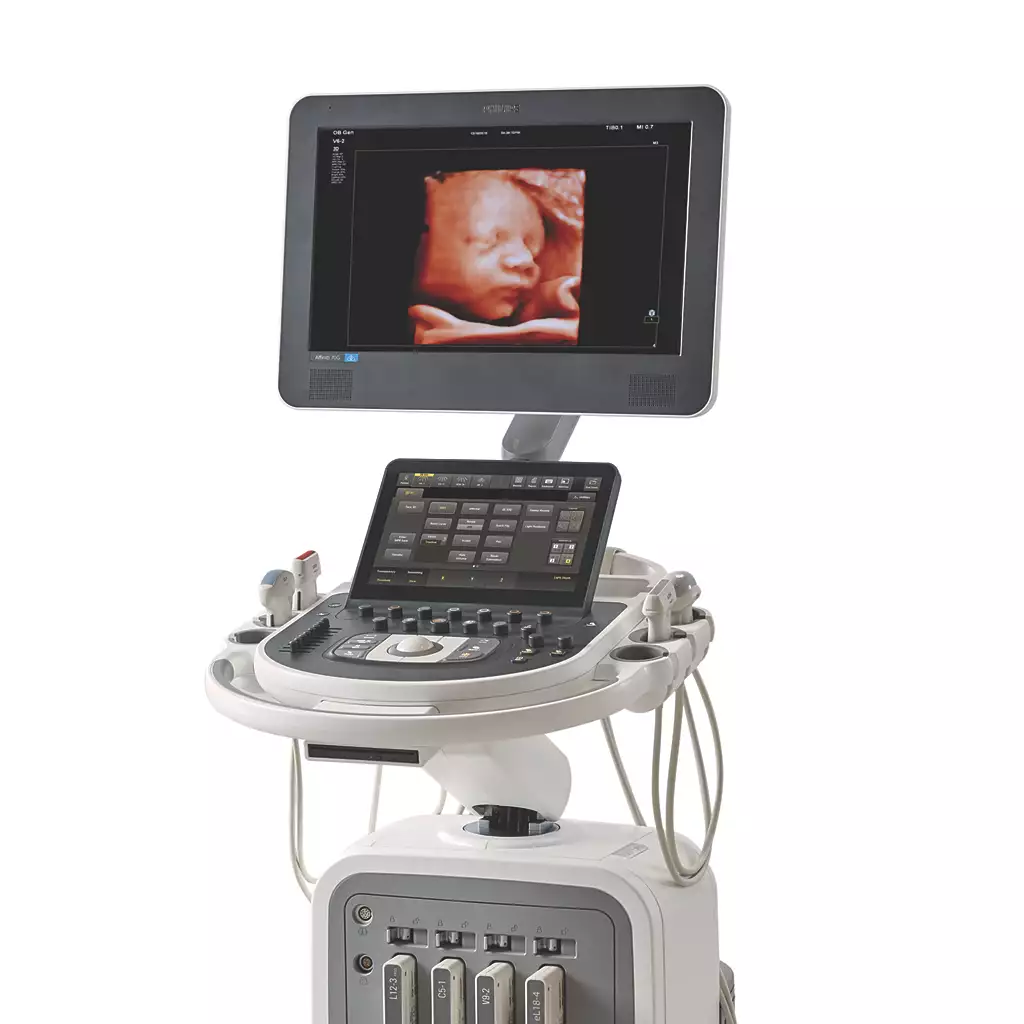 philips affiniti 70 ultrasound machine