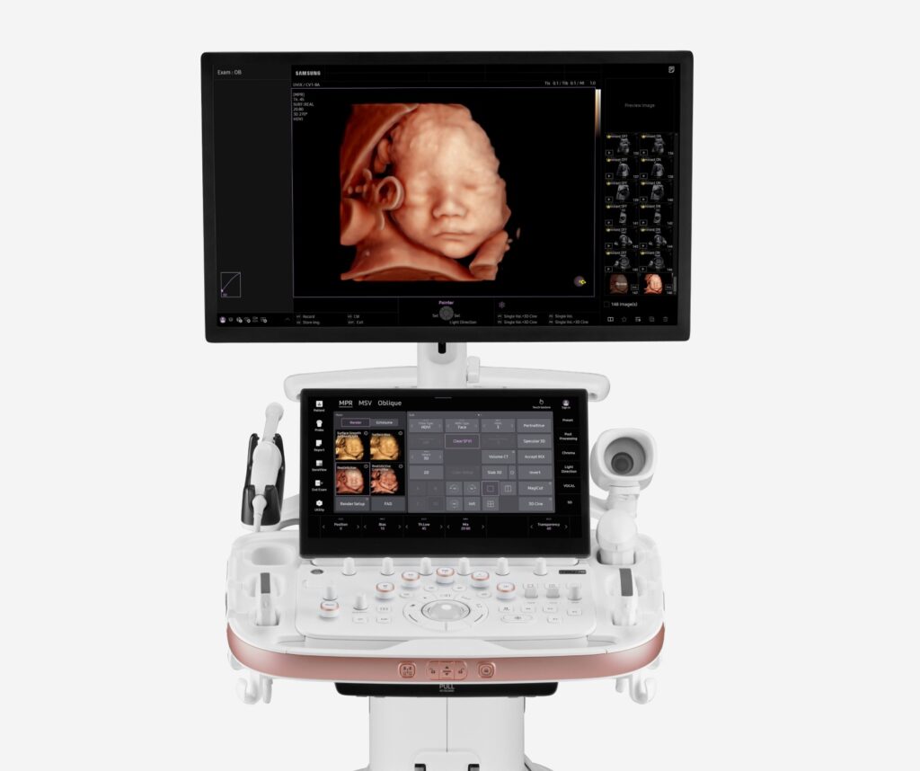 samsung hera z20 ultrasound