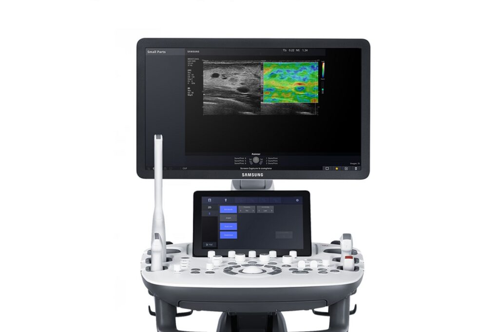 samsung v5 ultrasound machine photo