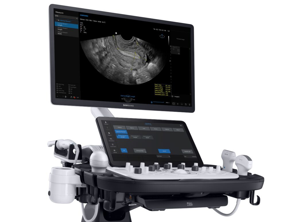 samsung v7 ultrasound closeup