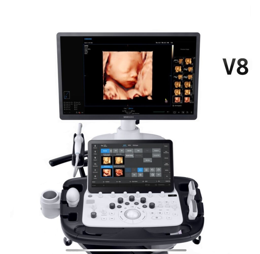 samsung v8 ultrasound