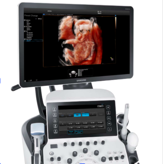 samsung ws80a ultrasound 4d