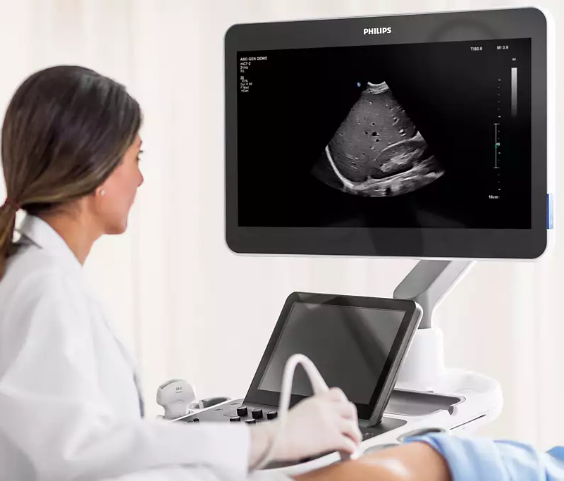 philips epiq ultrasound machine